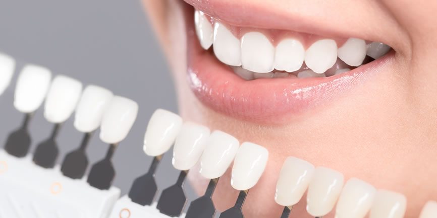 Estética Dental